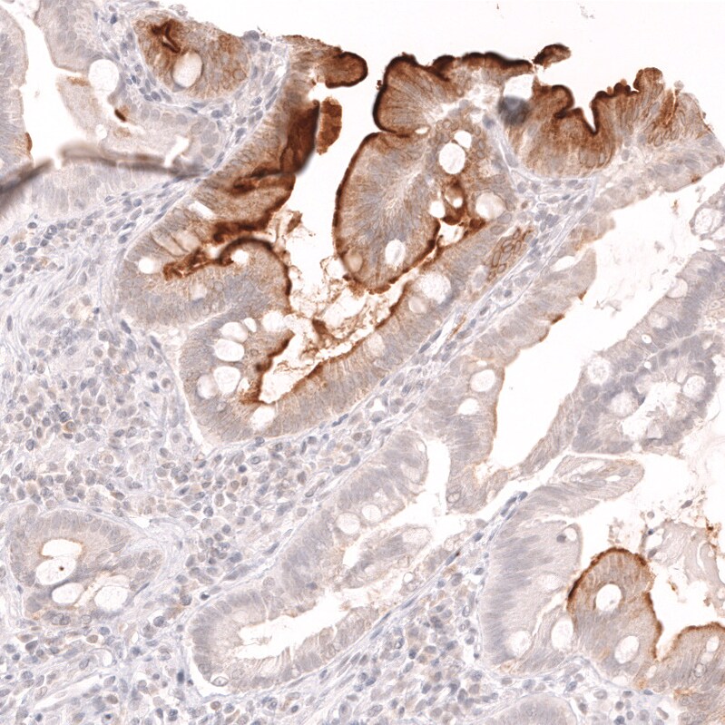 Lactase Antibody (CL14164) - Azide and BSA Free Immunohistochemistry-Paraffin: Lactase Antibody [NBP3-44274]