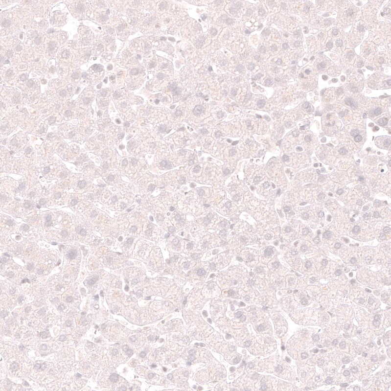 Lactase Antibody (CL14164) - Azide and BSA Free Immunohistochemistry-Paraffin: Lactase Antibody [NBP3-44274]