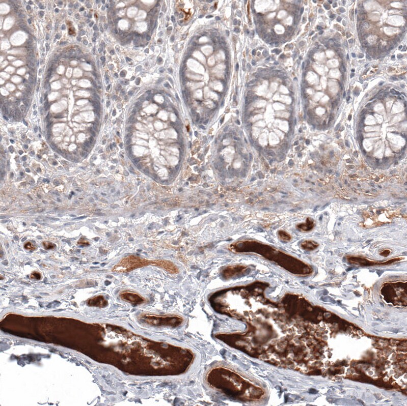 Serum Amyloid A1 Antibody (CL9175) - Azide and BSA Free Immunohistochemistry-Paraffin: Serum Amyloid A1 Antibody [NBP3-44275]