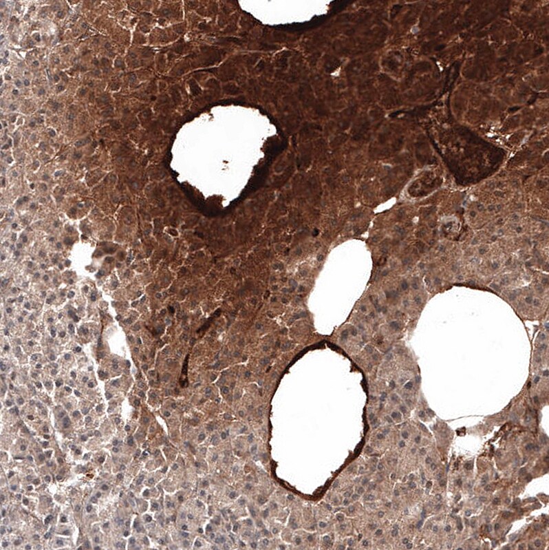 Serum Amyloid A1 Antibody (CL9175) - Azide and BSA Free Immunohistochemistry-Paraffin: Serum Amyloid A1 Antibody [NBP3-44275]