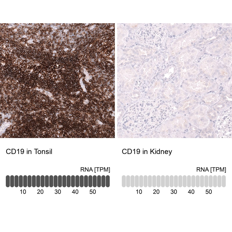 CD19 Antibody (CL15454) - Azide and BSA Free Immunohistochemistry-Paraffin: CD19 Antibody [NBP3-44277]