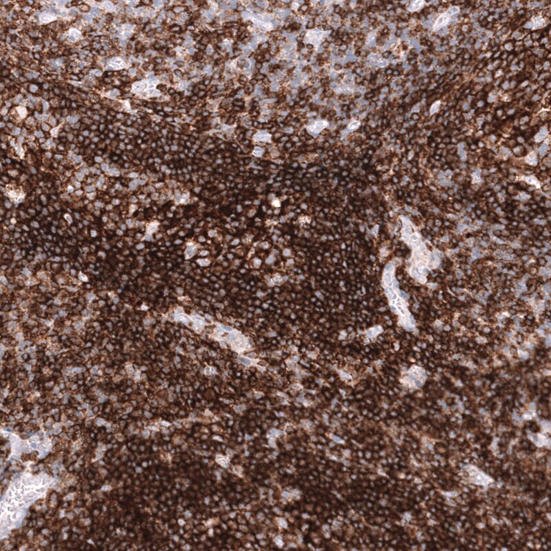 CD19 Antibody (CL15454) - Azide and BSA Free Immunohistochemistry-Paraffin: CD19 Antibody [NBP3-44277]