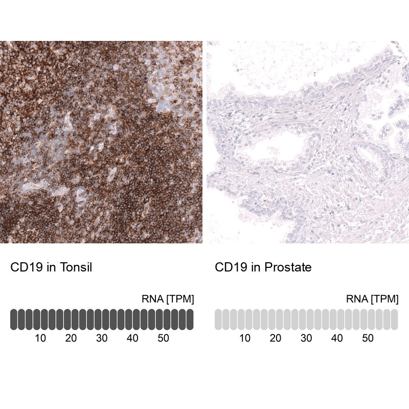 CD19 Antibody (CL15459) - Azide and BSA Free Immunohistochemistry-Paraffin: CD19 Antibody [NBP3-44278]