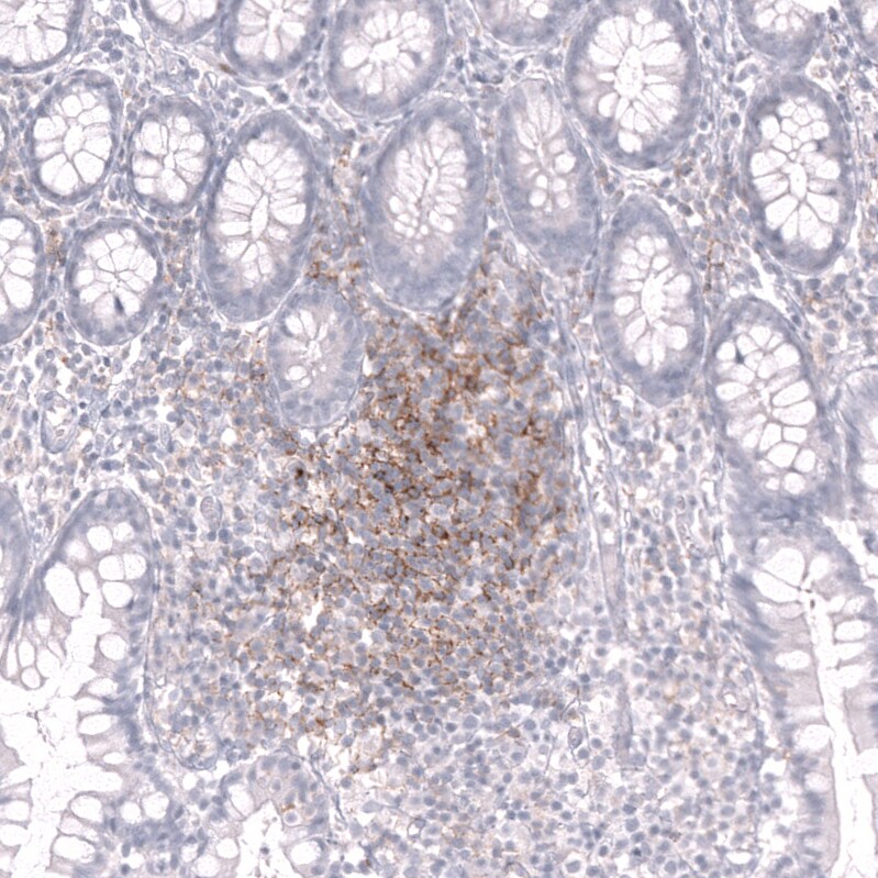CD19 Antibody (CL15459) - Azide and BSA Free Immunohistochemistry-Paraffin: CD19 Antibody [NBP3-44278]
