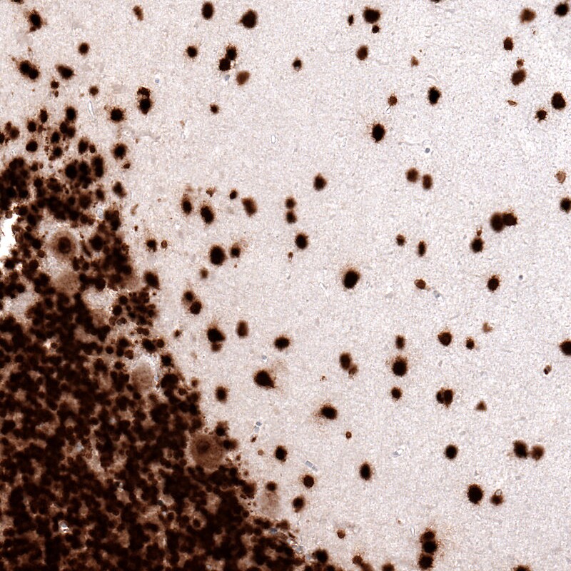 Histone H2AX Antibody (CL5157) - Azide and BSA Free Immunohistochemistry-Paraffin: Histone H2AX Antibody [NBP3-44279]
