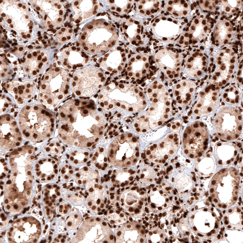 Histone H2AX Antibody (CL5157) - Azide and BSA Free Immunohistochemistry-Paraffin: Histone H2AX Antibody [NBP3-44279]