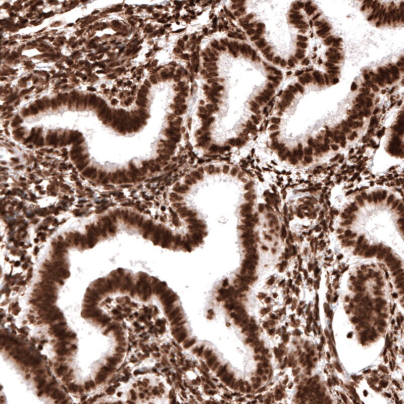 Histone H2AX Antibody (CL5157) - Azide and BSA Free Immunohistochemistry-Paraffin: Histone H2AX Antibody [NBP3-44279]