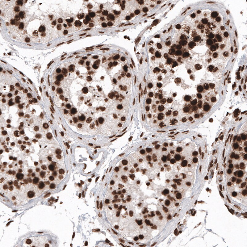 Histone H2AX Antibody (CL5157) - Azide and BSA Free Immunohistochemistry-Paraffin: Histone H2AX Antibody [NBP3-44279]