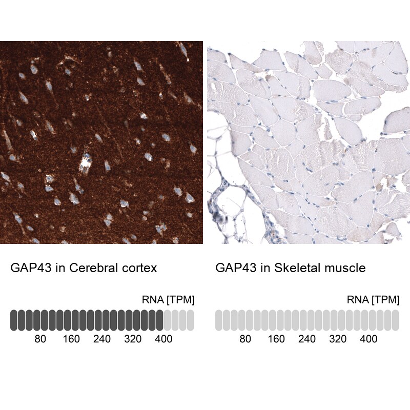 GAP-43 Antibody (CL10847) - Azide and BSA Free Immunohistochemistry-Paraffin: GAP-43 Antibody [NBP3-44282]