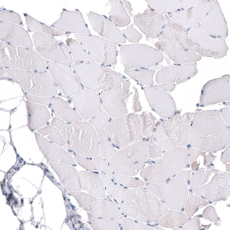 GAP-43 Antibody (CL10847) - Azide and BSA Free Immunohistochemistry-Paraffin: GAP-43 Antibody [NBP3-44282]
