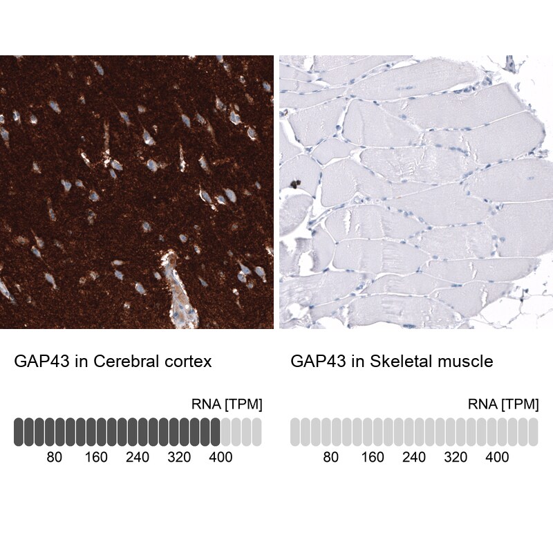 GAP-43 Antibody (CL10855) - Azide and BSA Free Immunohistochemistry-Paraffin: GAP-43 Antibody [NBP3-44283]