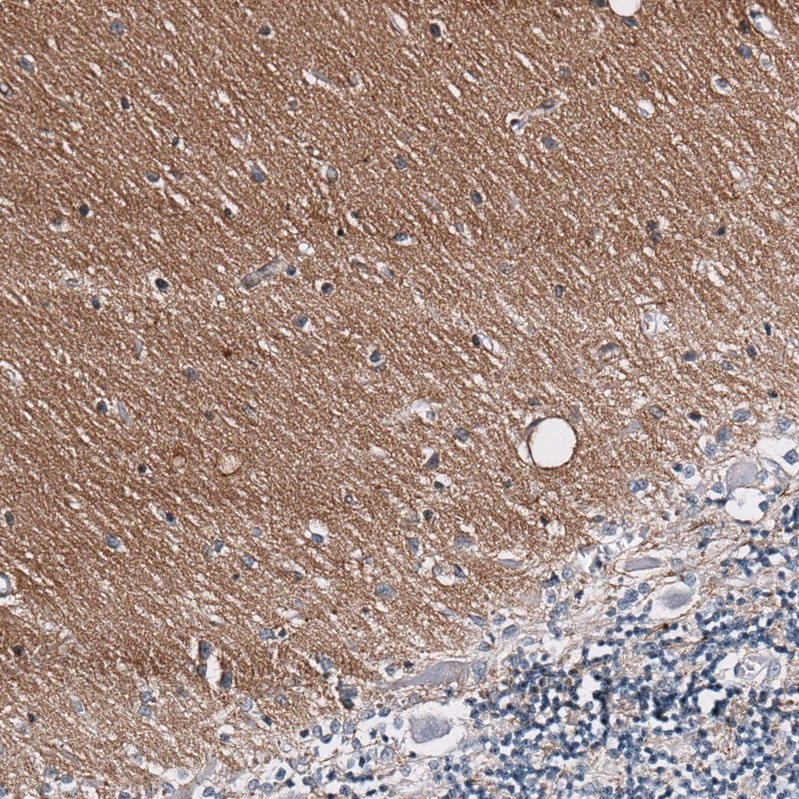 GAP-43 Antibody (CL10884) - Azide and BSA Free Immunohistochemistry-Paraffin: GAP-43 Antibody [NBP3-44284]
