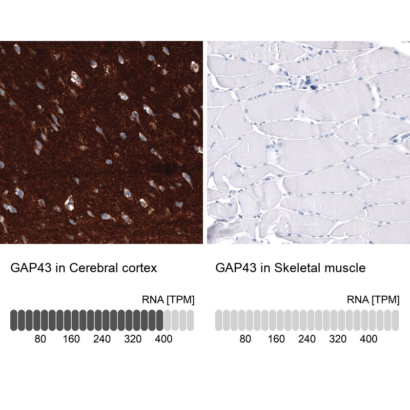 GAP-43 Antibody (CL10884) - Azide and BSA Free Immunohistochemistry-Paraffin: GAP-43 Antibody [NBP3-44284]
