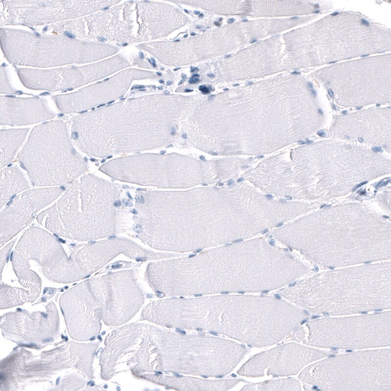 GAP-43 Antibody (CL10884) - Azide and BSA Free Immunohistochemistry-Paraffin: GAP-43 Antibody [NBP3-44284]