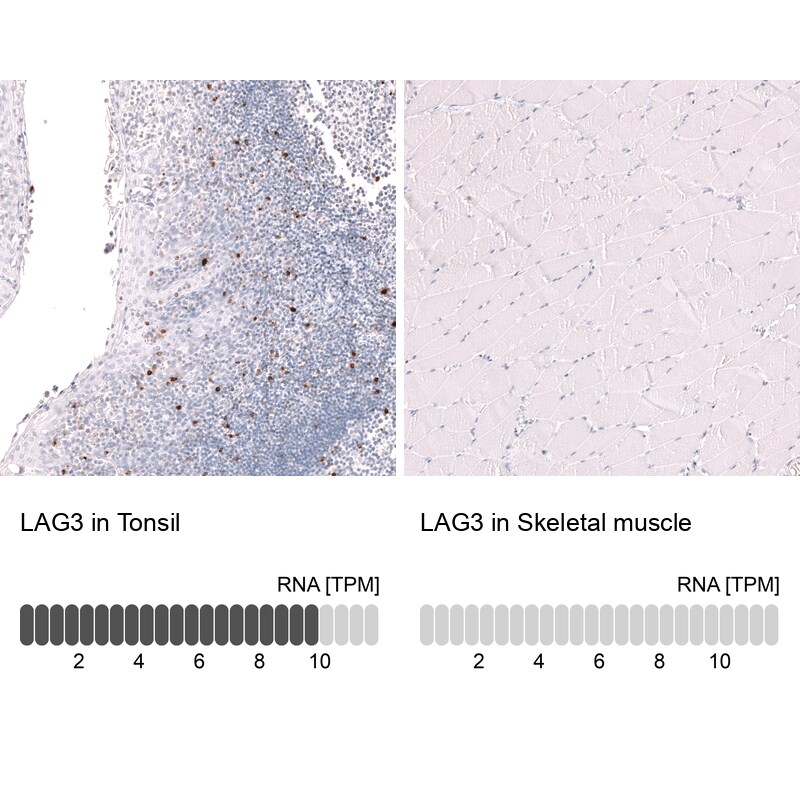 LAG-3 Antibody (CL14773) - Azide and BSA Free Immunohistochemistry-Paraffin: LAG-3 Antibody [NBP3-44285]