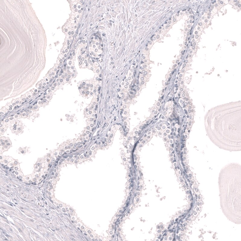 LAG-3 Antibody (CL14773) - Azide and BSA Free Immunohistochemistry-Paraffin: LAG-3 Antibody [NBP3-44285]