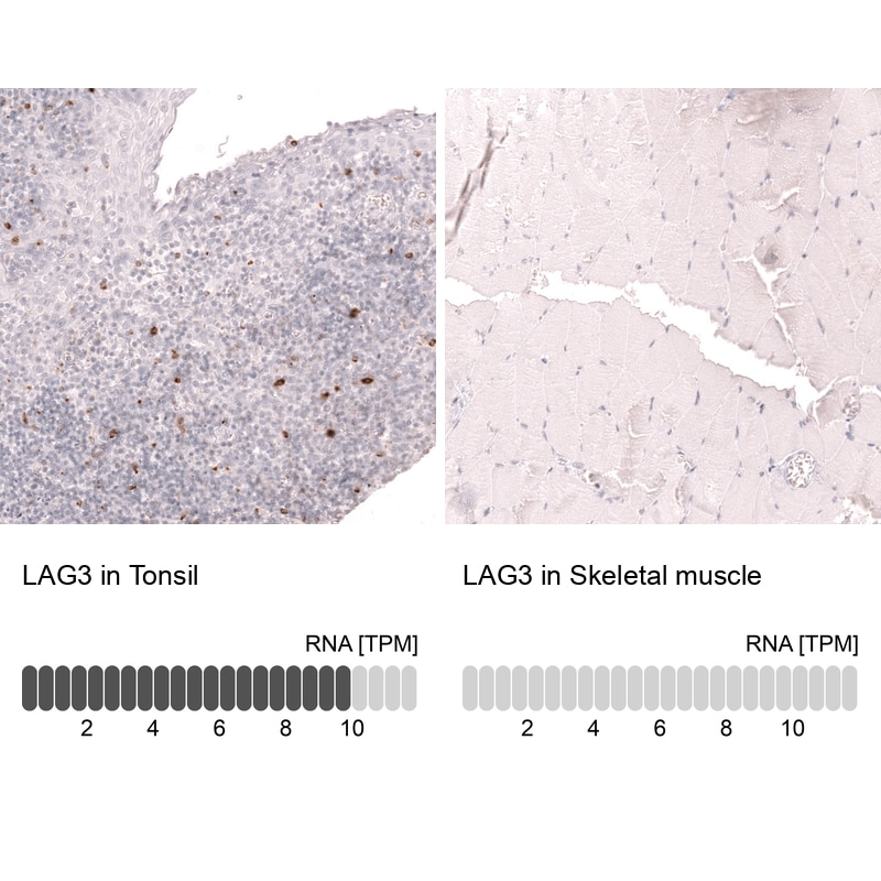 LAG-3 Antibody (CL14765) - Azide and BSA Free Immunohistochemistry-Paraffin: LAG-3 Antibody [NBP3-44286]