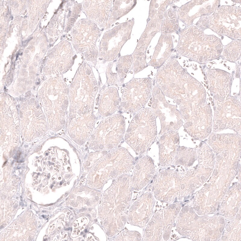 LAG-3 Antibody (CL14765) - Azide and BSA Free Immunohistochemistry-Paraffin: LAG-3 Antibody [NBP3-44286]