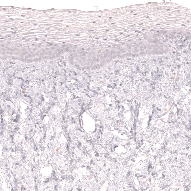 LAG-3 Antibody (CL14765) - Azide and BSA Free Immunohistochemistry-Paraffin: LAG-3 Antibody [NBP3-44286]