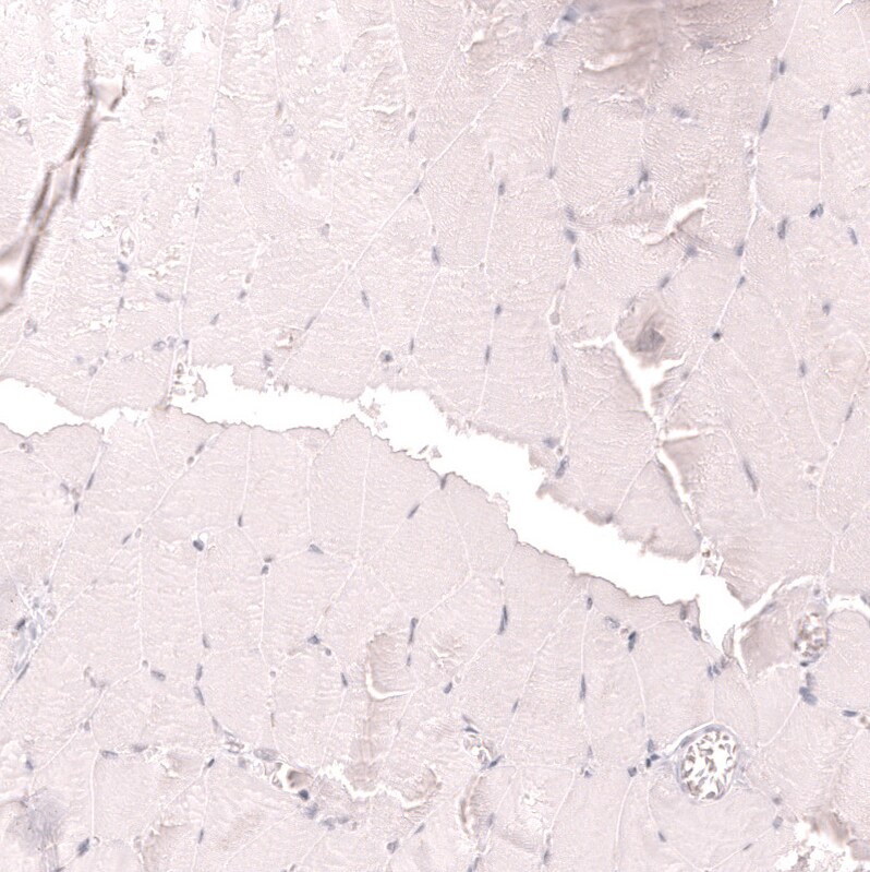 LAG-3 Antibody (CL14765) - Azide and BSA Free Immunohistochemistry-Paraffin: LAG-3 Antibody [NBP3-44286]