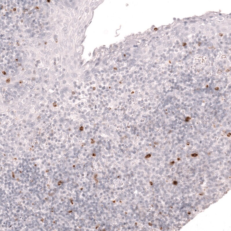 LAG-3 Antibody (CL14765) - Azide and BSA Free Immunohistochemistry-Paraffin: LAG-3 Antibody [NBP3-44286]