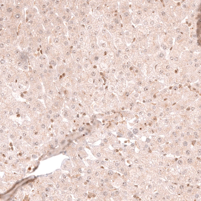 TFEB Antibody (CL14112) - Azide and BSA Free Immunohistochemistry-Paraffin: TFEB Antibody [NBP3-44287]