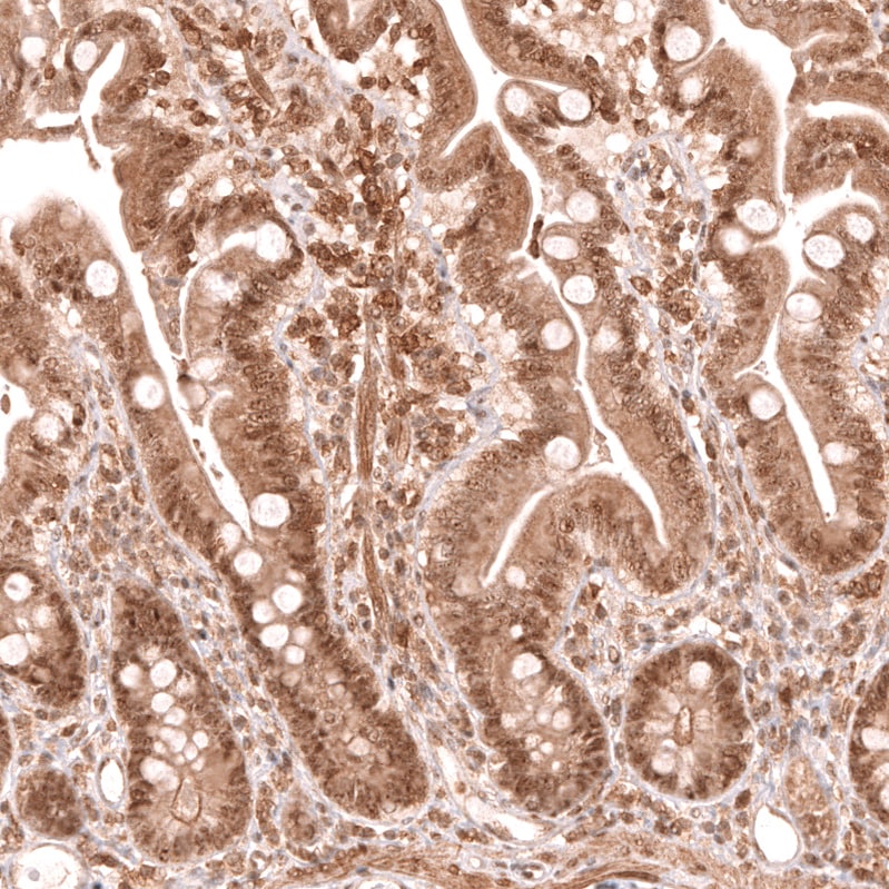 TFEB Antibody (CL14112) - Azide and BSA Free Immunohistochemistry-Paraffin: TFEB Antibody [NBP3-44287]