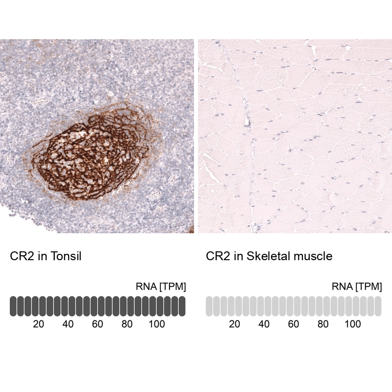 CD21 Antibody (CL14552) - Azide and BSA Free Immunohistochemistry-Paraffin: CD21 Antibody [NBP3-44288]