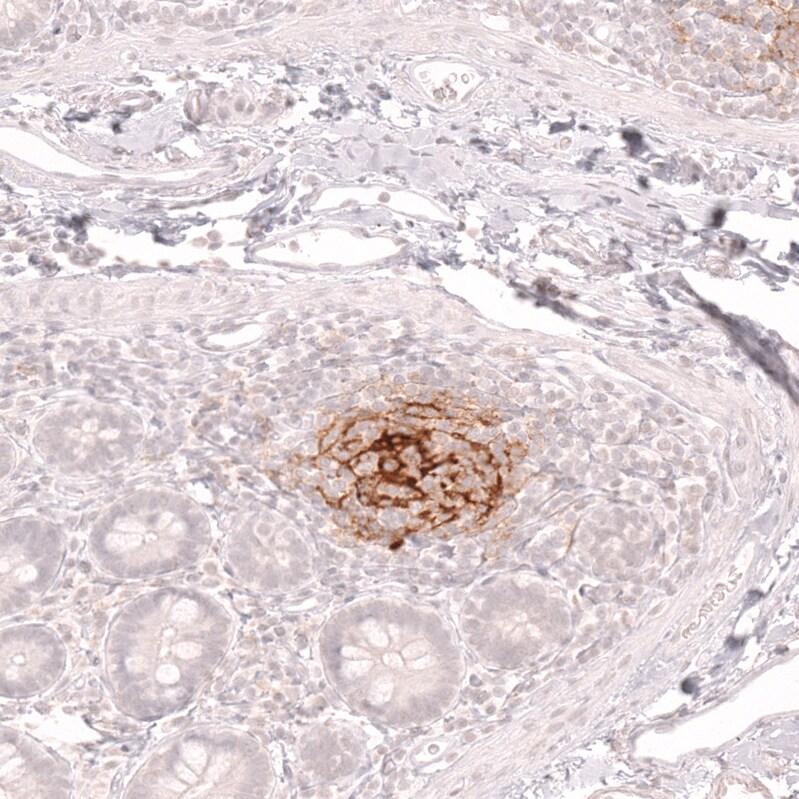 CD21 Antibody (CL14552) - Azide and BSA Free Immunohistochemistry-Paraffin: CD21 Antibody [NBP3-44288]