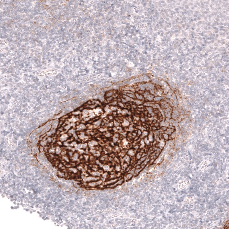 CD21 Antibody (CL14552) - Azide and BSA Free Immunohistochemistry-Paraffin: CD21 Antibody [NBP3-44288]
