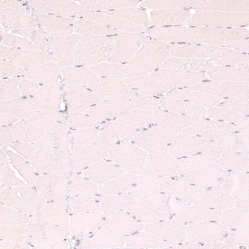 CD21 Antibody (CL14552) - Azide and BSA Free Immunohistochemistry-Paraffin: CD21 Antibody [NBP3-44288]