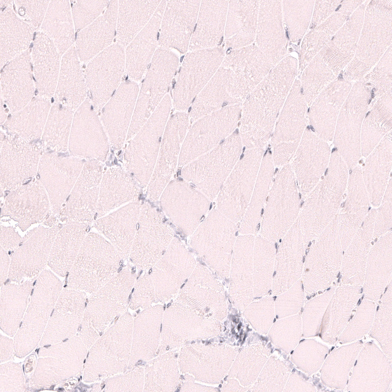 CD21 Antibody (CL14556) - Azide and BSA Free Immunohistochemistry-Paraffin: CD21 Antibody [NBP3-44289]