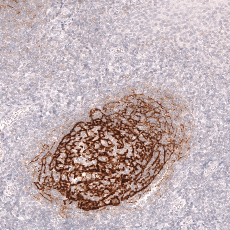 CD21 Antibody (CL14556) - Azide and BSA Free Immunohistochemistry-Paraffin: CD21 Antibody [NBP3-44289]