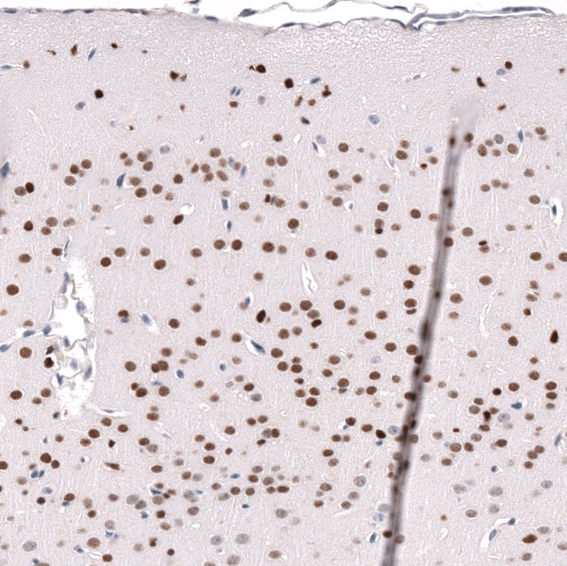 POU3F3 Antibody (CL15302) - Azide and BSA Free Immunohistochemistry-Paraffin: POU3F3 Antibody [NBP3-44291]