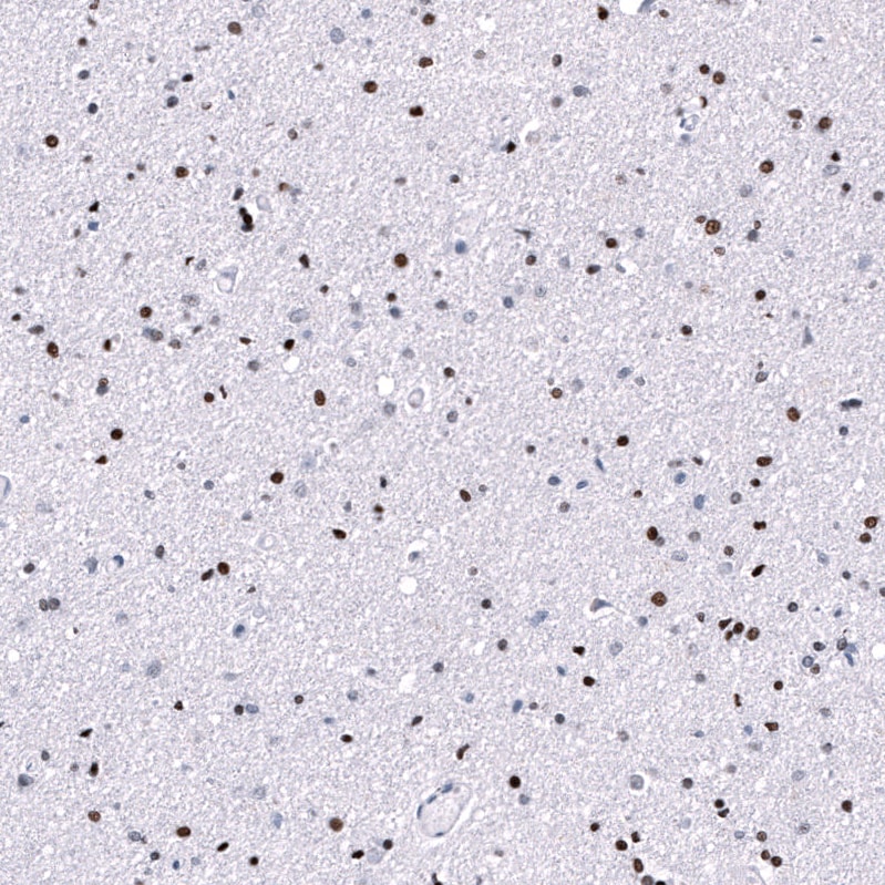 POU3F3 Antibody (CL15308) - Azide and BSA Free Immunohistochemistry-Paraffin: POU3F3 Antibody [NBP3-44292]