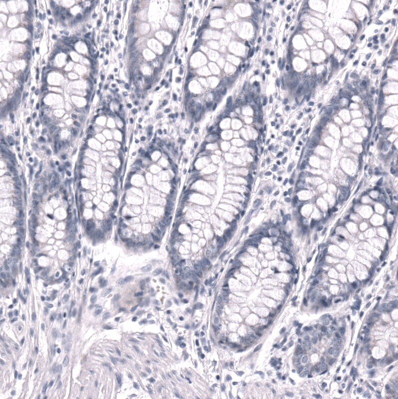 POU3F3 Antibody (CL15308) - Azide and BSA Free Immunohistochemistry-Paraffin: POU3F3 Antibody [NBP3-44292]
