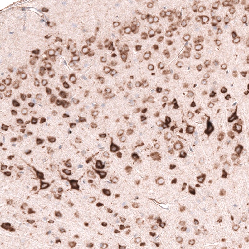 Pleiotrophin/PTN Antibody (CL15628) - Azide and BSA Free Immunohistochemistry-Paraffin: Pleiotrophin/PTN Antibody [NBP3-44293]