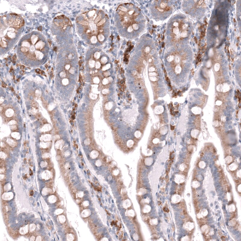 CD27/TNFRSF7 Antibody (CL15464) - Azide and BSA Free Immunohistochemistry-Paraffin: CD27/TNFRSF7 Antibody [NBP3-44297]