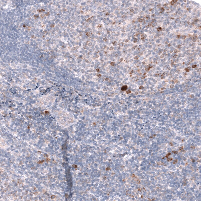 CD27/TNFRSF7 Antibody (CL15464) - Azide and BSA Free Immunohistochemistry-Paraffin: CD27/TNFRSF7 Antibody [NBP3-44297]