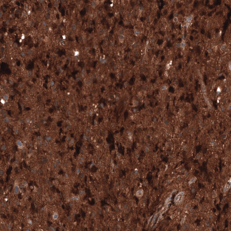 Chitinase 3-like 1/YKL-40 Antibody (CL12241) - Azide and BSA Free Immunohistochemistry-Paraffin: Chitinase 3-like 1/YKL-40 Antibody [NBP3-44298]