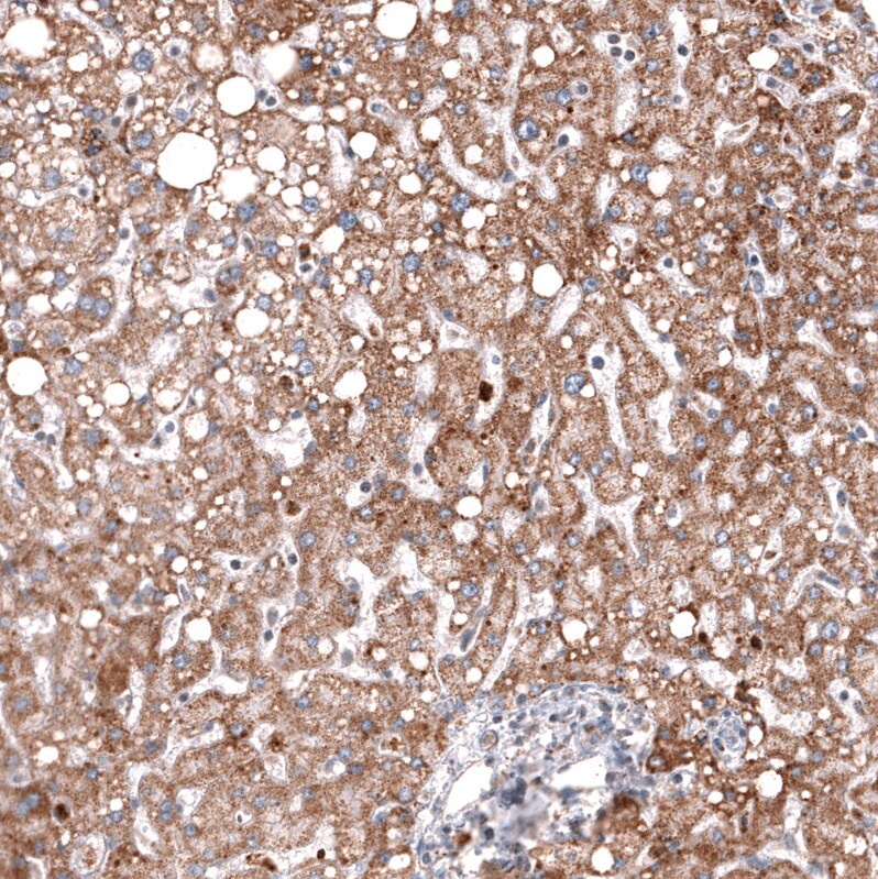 Chitinase 3-like 1/YKL-40 Antibody (CL12241) - Azide and BSA Free Immunohistochemistry-Paraffin: Chitinase 3-like 1/YKL-40 Antibody [NBP3-44298]