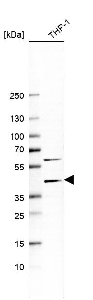 Chitinase 3-like 1/YKL-40 Antibody (CL12241) - Azide and BSA Free Western Blot: Chitinase 3-like 1/YKL-40 Antibody [NBP3-44298]