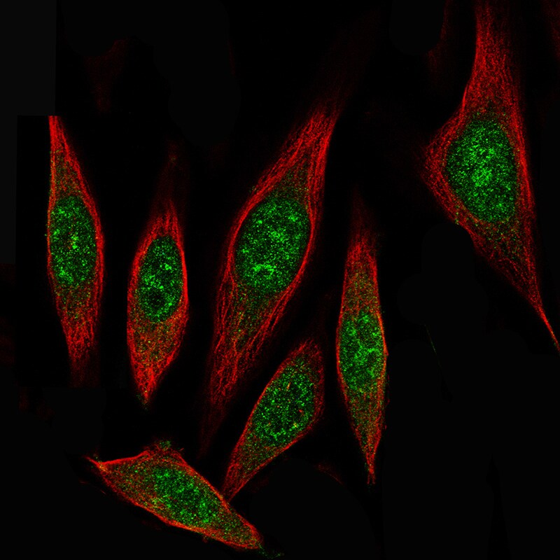 ID1 Antibody (CL11981) - Azide and BSA Free Immunocytochemistry/ Immunofluorescence: ID1 Antibody [NBP3-44300]