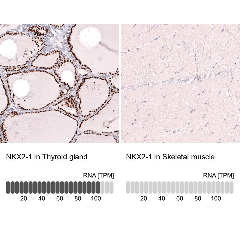 TTF-1 / NKX2-1 Antibody (CL14523) - Azide and BSA Free Immunohistochemistry-Paraffin: TTF-1 / NKX2-1 Antibody [NBP3-44302]