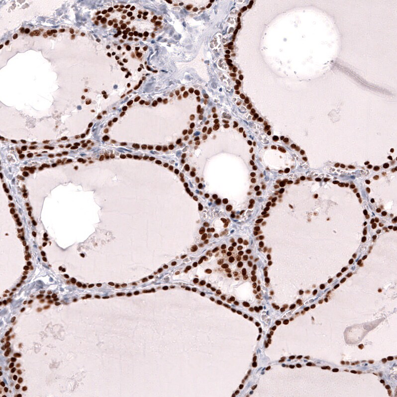 TTF-1 / NKX2-1 Antibody (CL14523) - Azide and BSA Free Immunohistochemistry-Paraffin: TTF-1 / NKX2-1 Antibody [NBP3-44302]
