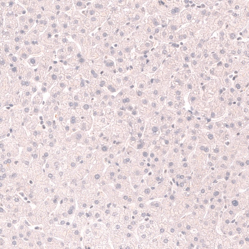 TTF-1 / NKX2-1 Antibody (CL14523) - Azide and BSA Free Immunohistochemistry-Paraffin: TTF-1 / NKX2-1 Antibody [NBP3-44302]