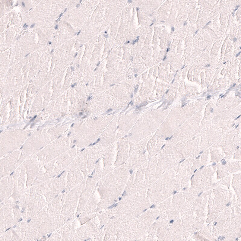 TTF-1 / NKX2-1 Antibody (CL14528) - Azide and BSA Free Immunohistochemistry-Paraffin: TTF-1 / NKX2-1 Antibody [NBP3-44303]