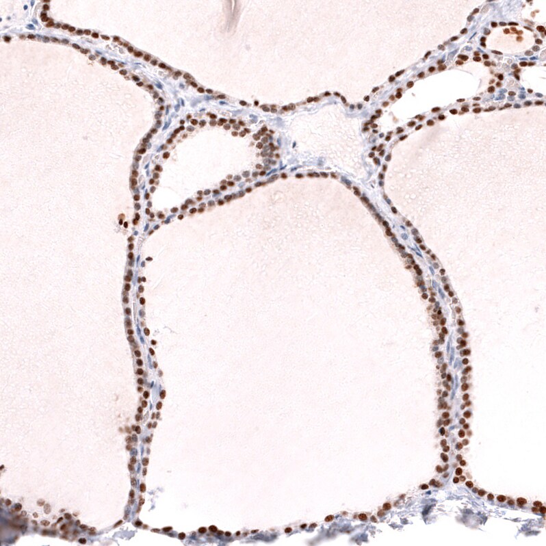 TTF-1 / NKX2-1 Antibody (CL14528) - Azide and BSA Free Immunohistochemistry-Paraffin: TTF-1 / NKX2-1 Antibody [NBP3-44303]