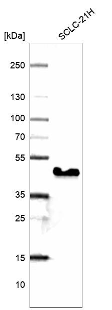 TTF-1 / NKX2-1 Antibody (CL14528) - Azide and BSA Free Western Blot: TTF-1 / NKX2-1 Antibody [NBP3-44303]