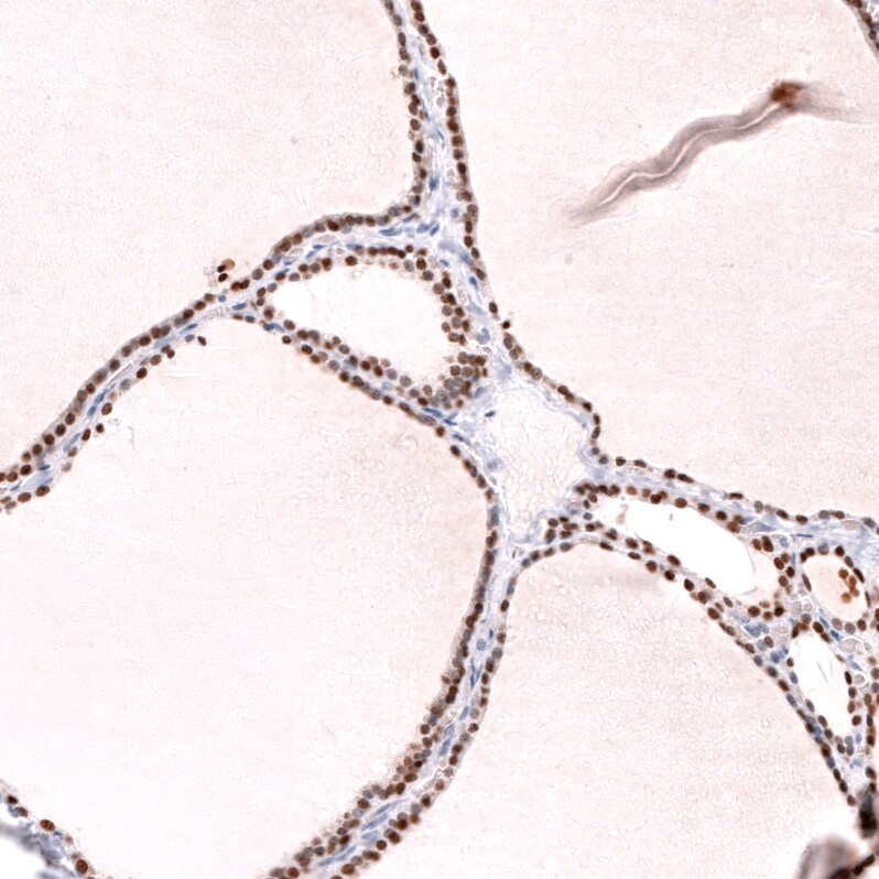 TTF-1 / NKX2-1 Antibody (CL14531) - Azide and BSA Free Immunohistochemistry-Paraffin: TTF-1 / NKX2-1 Antibody [NBP3-44304]